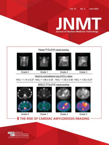 Journal of Nuclear Medicine Technology: 51 (2)